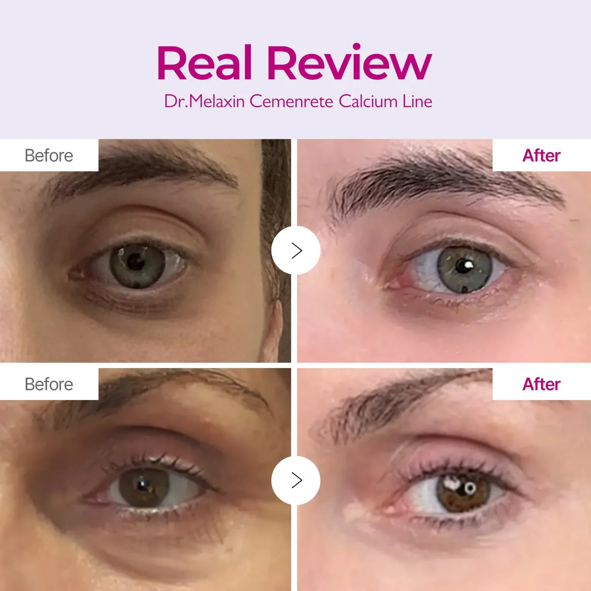 Dr. Melaxin Cemenrete Calcium Intense Ampoule Plus