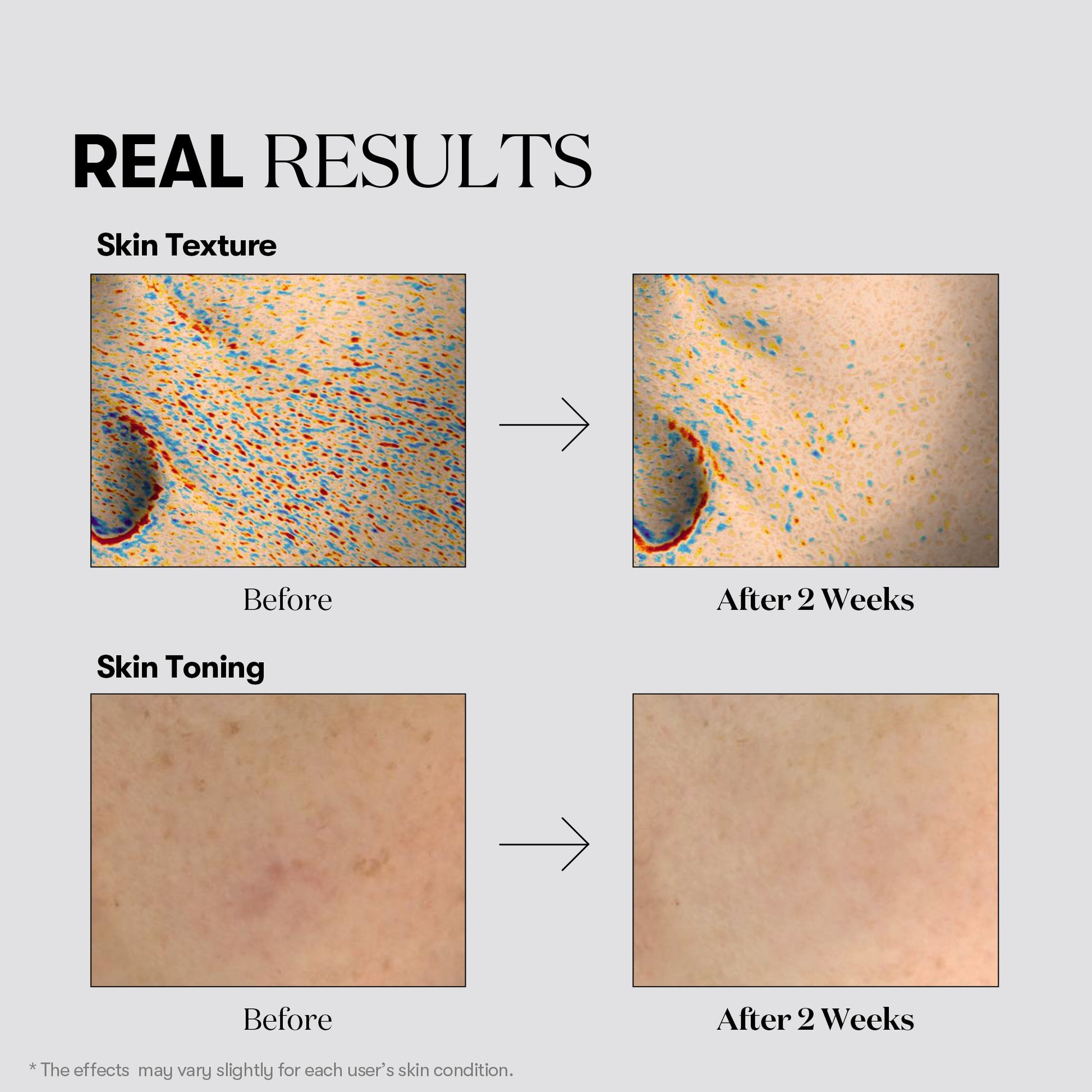 VT Cosmetics TX-Toning Daily Mask