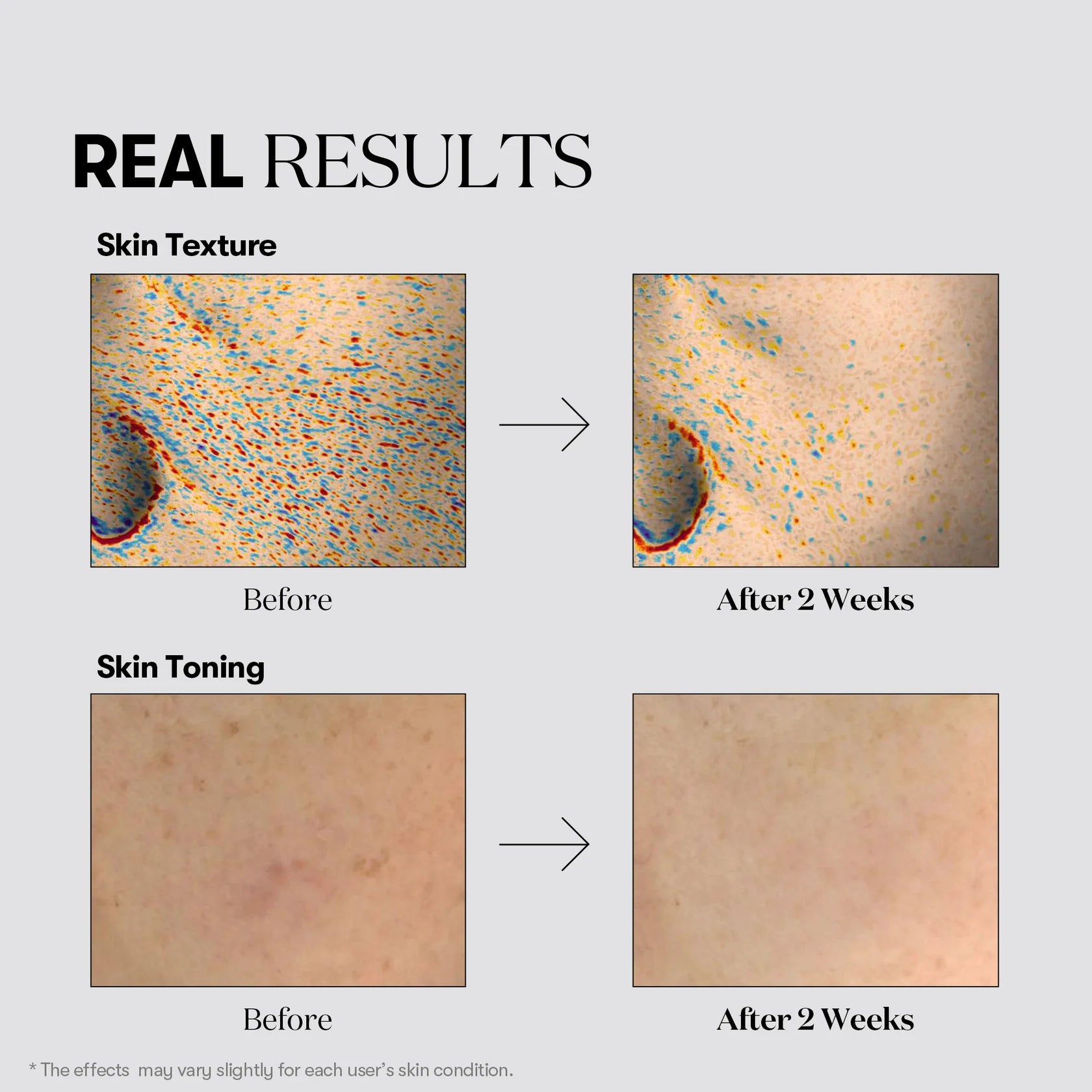 Vt Cosmetics TX-Toning Cream