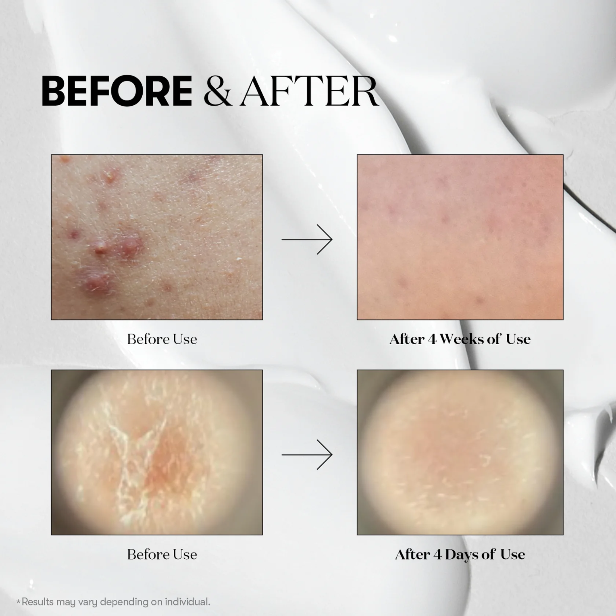 VT Cosmetics Reedle Shot 100