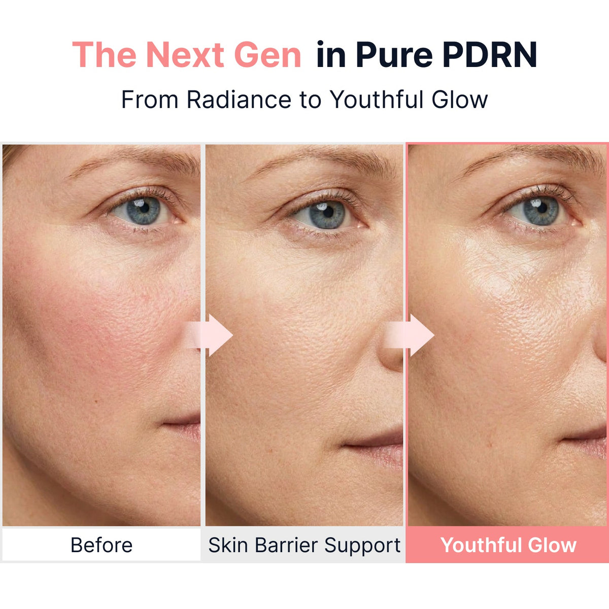 Sungboon Editor PDRN Pink Vitamin Glow Boosting Ampoule 40ml – Vorher/Nachher