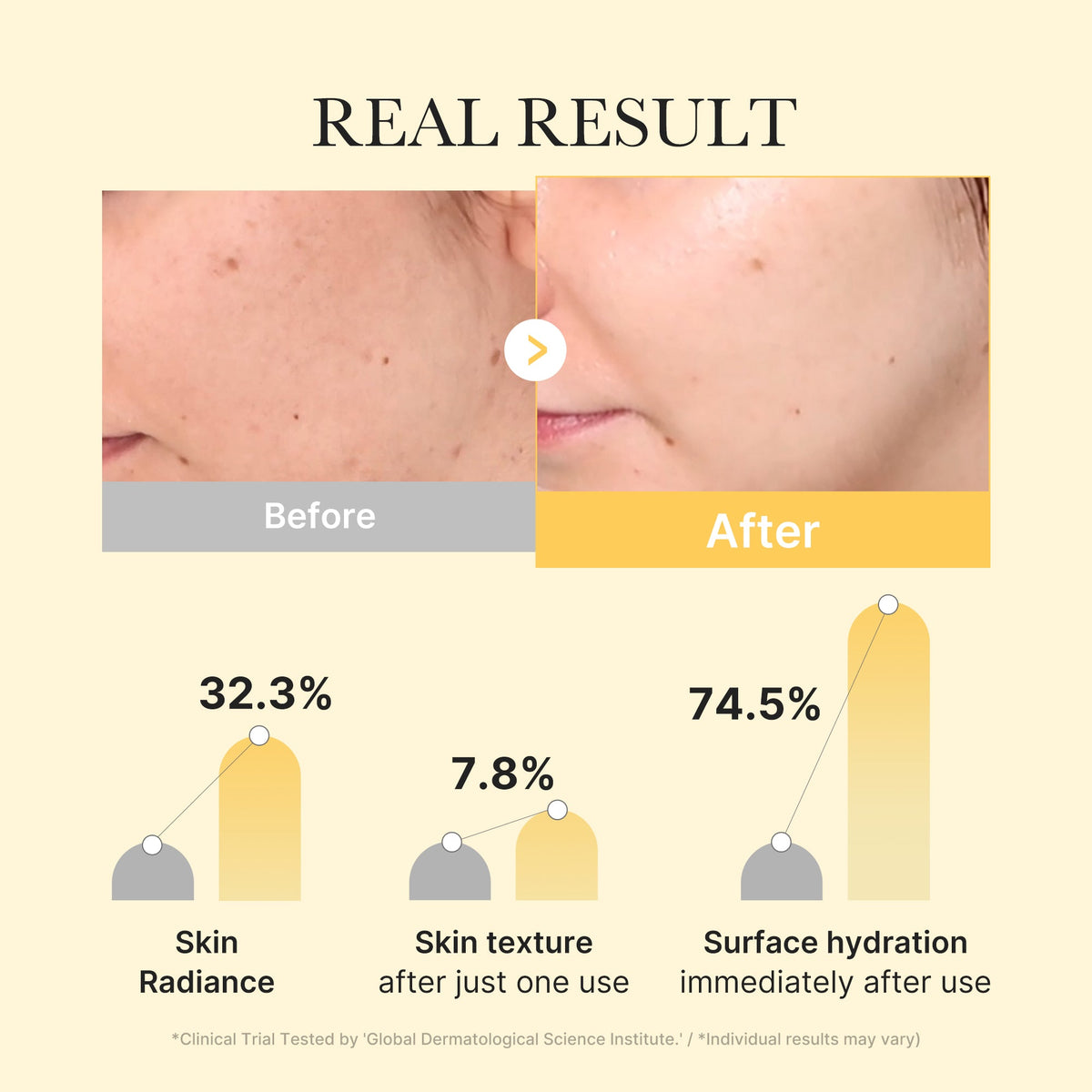 Medicube Kojic Acid Turmeric Brightening Gel Mask 4 Stück – Anwendung im Gesicht