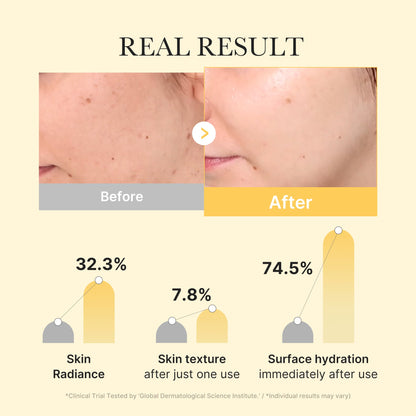 Medicube Kojic Acid Turmeric Brightening Gel Mask 4 Stück – Anwendung im Gesicht