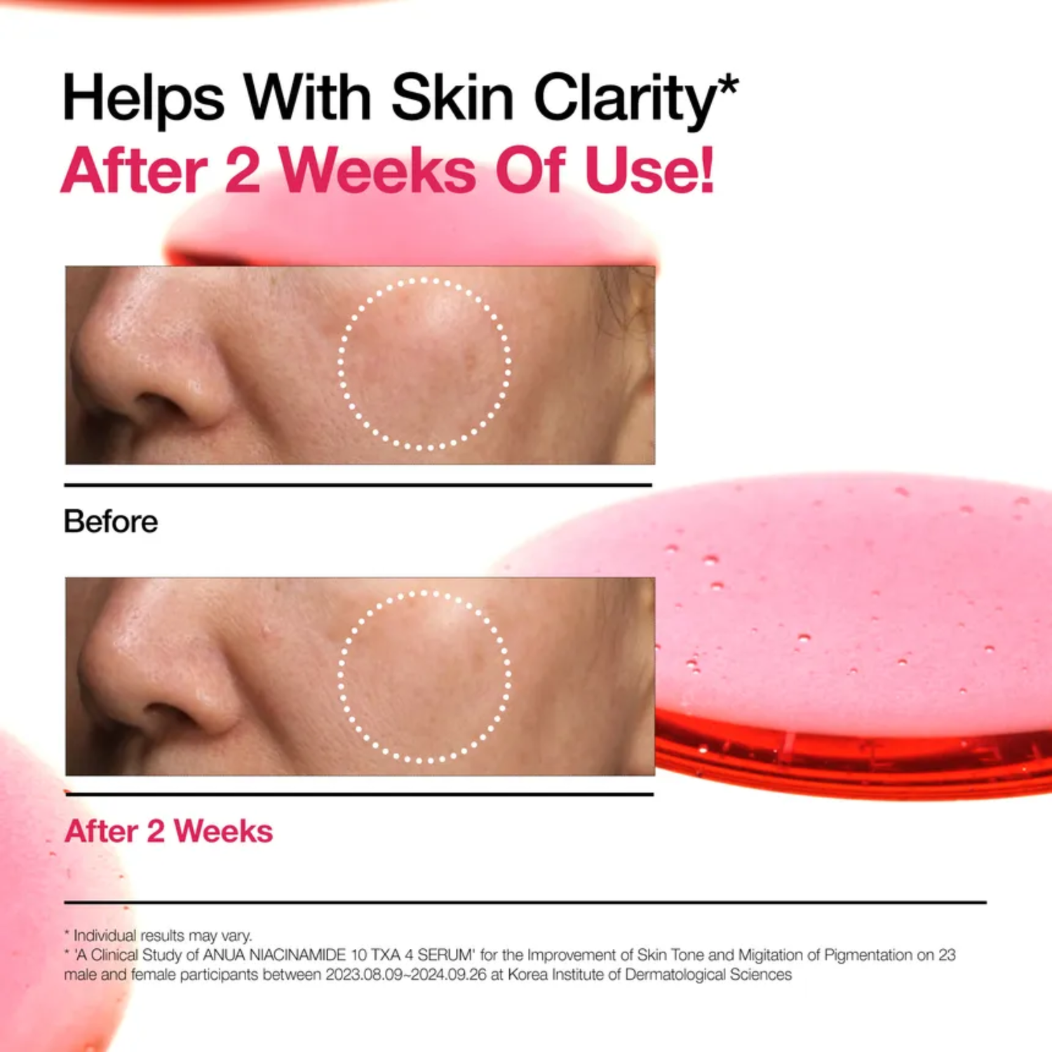 Anua Niacinamide 10%+TXA 4% Serum