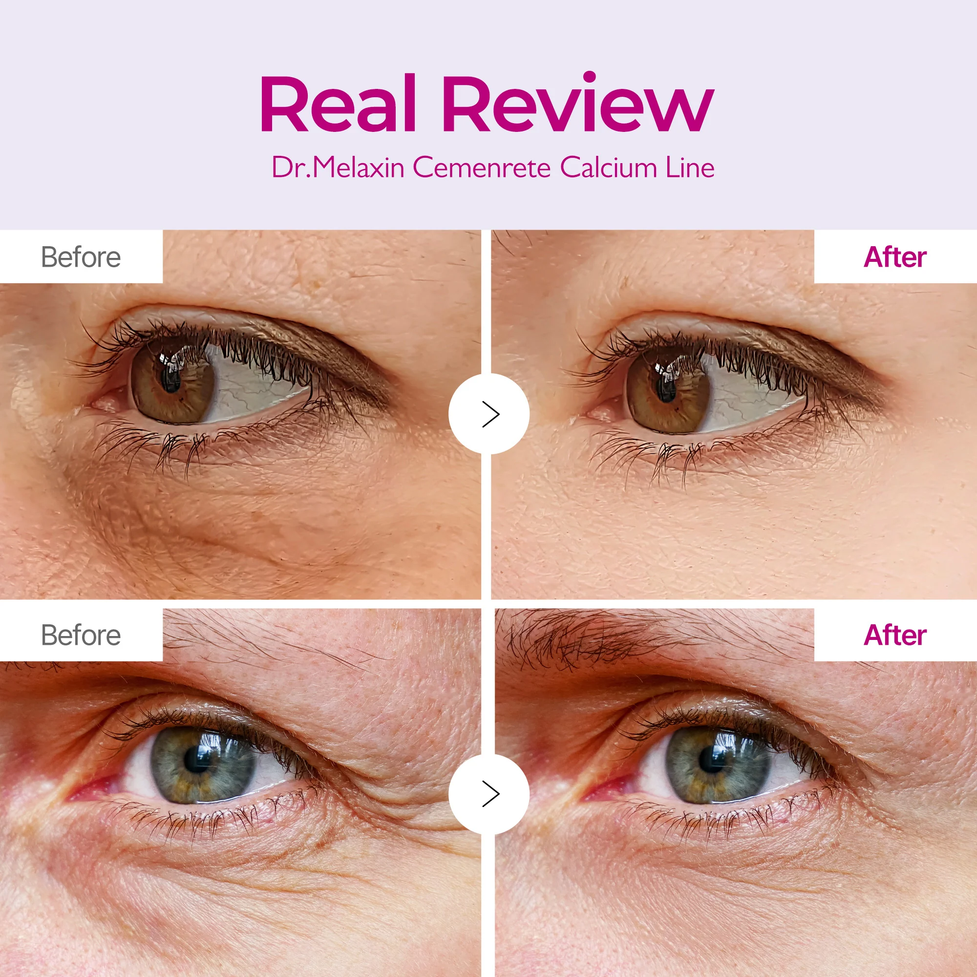 Dr.Melaxin Cemenrete Calcium Volume Eye Patch