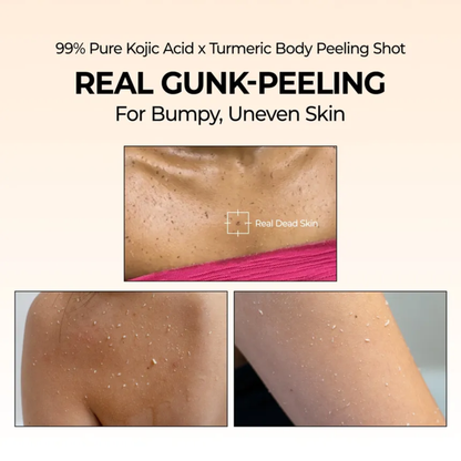 Dr.Melaxin Peel Shot Exfoliating Kojic Acid Turmeric Spray - Körperpeeling Spray 200ml