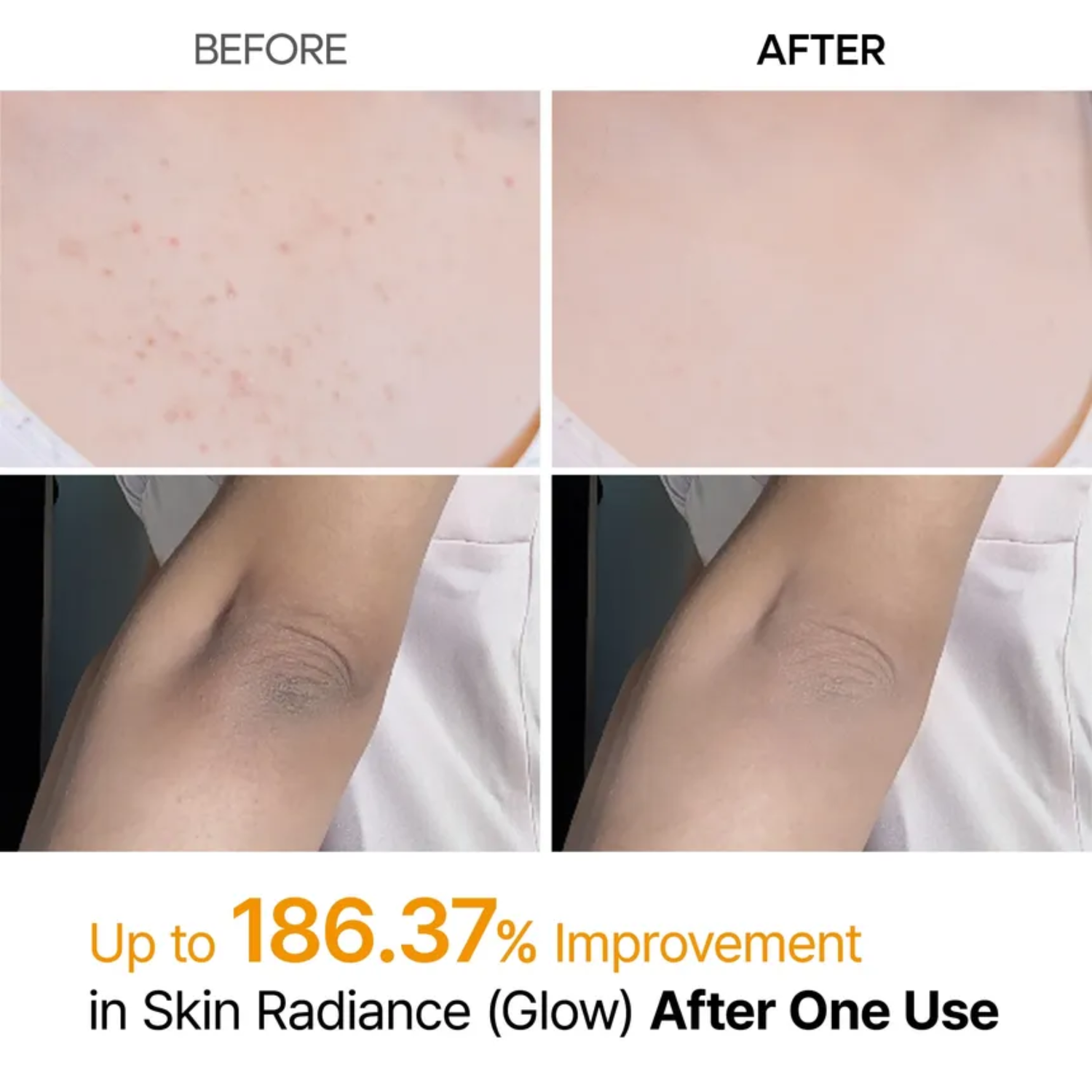 Dr.Melaxin Peel Shot Exfoliating Kojic Acid Turmeric Spray - Körperpeeling Spray 200ml