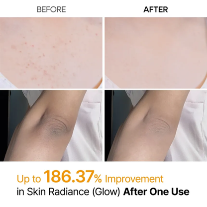 Dr.Melaxin Peel Shot Exfoliating Kojic Acid Turmeric Spray - Körperpeeling Spray 200ml